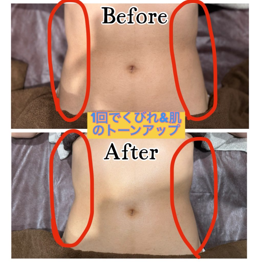 痩せるエステ　泉大津　サロン